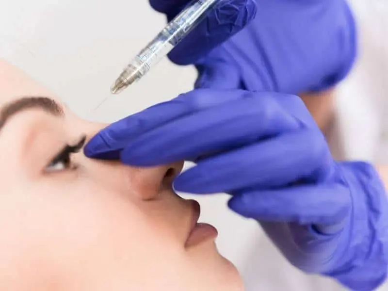 Non-Surgical Rhinoplasty